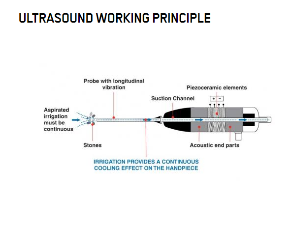 Pzt Materiaal Piezo Keramiek Ring Piezoceramic Transducers vir Ultrasoniese Litotripsy
